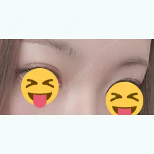 295 days after image