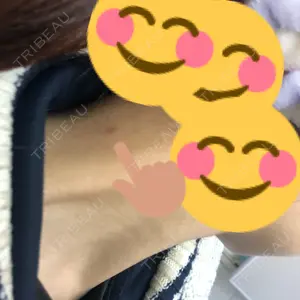 21 days after image