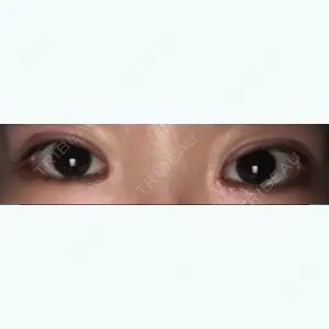 id（アイディ）美容外科のチェ・ジェホ医師口コミ