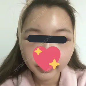 2 days after image