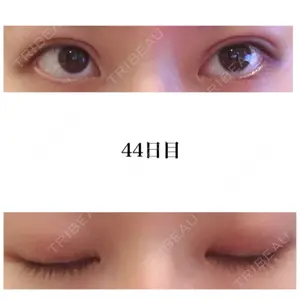 44 days after image