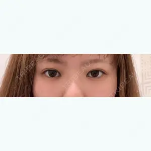 36 days after image
