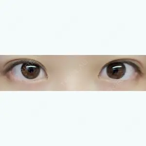 52 days after image
