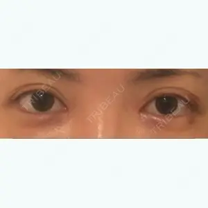 61 days after image