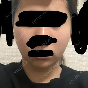 84 days after image