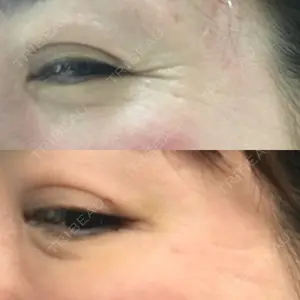 6 days after image