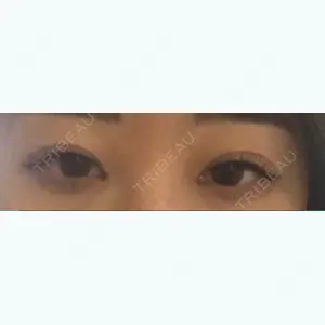 53 days after image