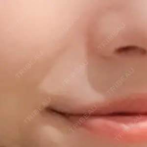 39 days after image