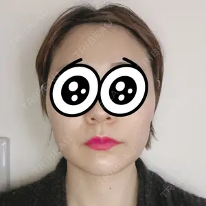 4ever（フォーエバー）美容外科・皮膚科 ソウル駅店口コミ