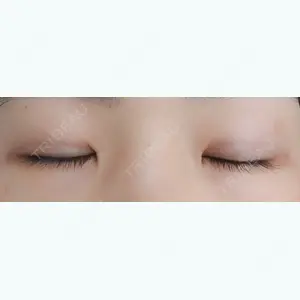14 days after image