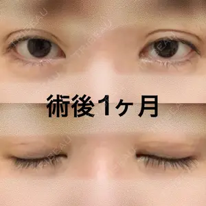 31 days after image