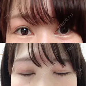 19 days after image