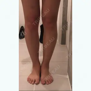 24 days after image