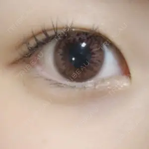 25 days after image