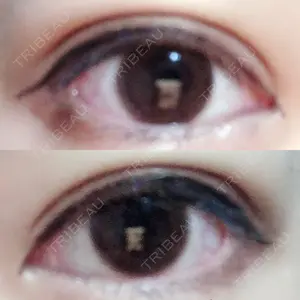 6 days after image