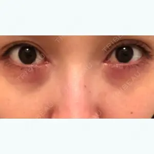 10 days after image