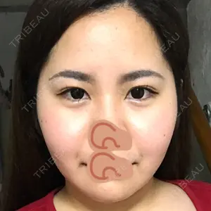 133 days after image