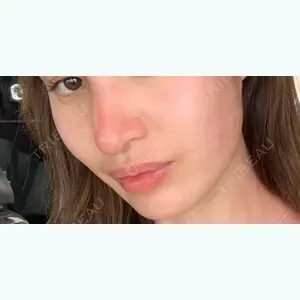 79 days after image