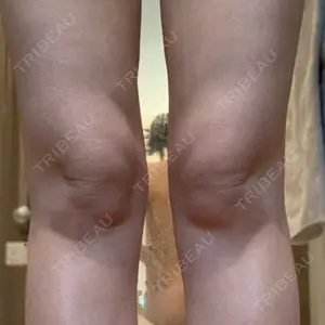 49 days after image