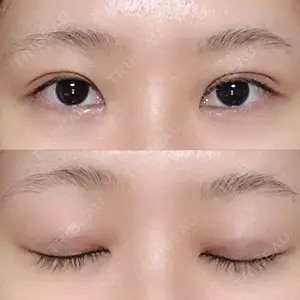 10 days after image