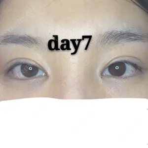 7 days after image