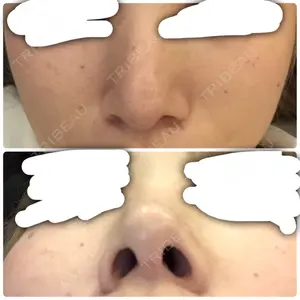 92 days after image