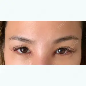 5 days after image
