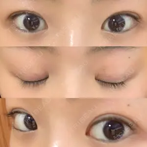 38 days after image