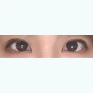 11 days after image