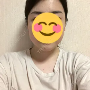 31 days after image