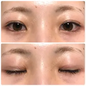 31 days after image