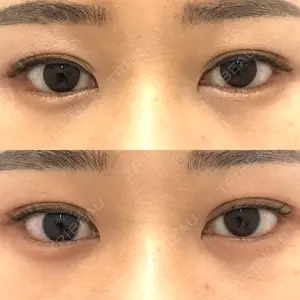 85 days after image