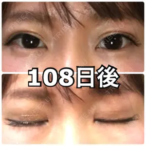 108 days after image