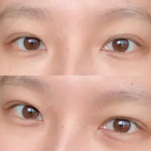 15 days after image