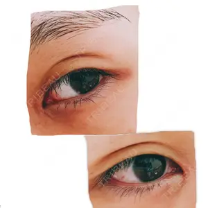 17 days after image