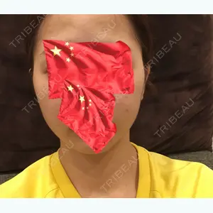 7 days after image