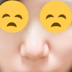 リエンジャン整形外科 弘大店口コミ