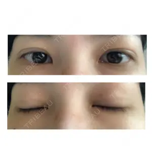 21 days after image