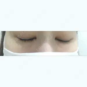 30 days after image