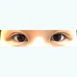 23 days after image