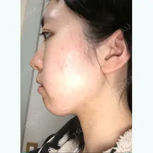 21 days after image