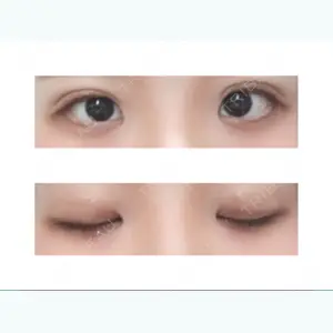 7 days after image