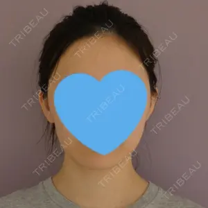 64 days after image