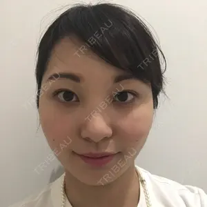 28 days after image
