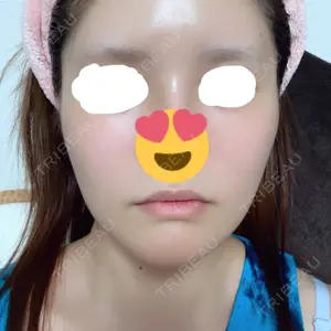 12 days after image