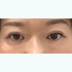 32 days after image