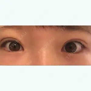31 days after image