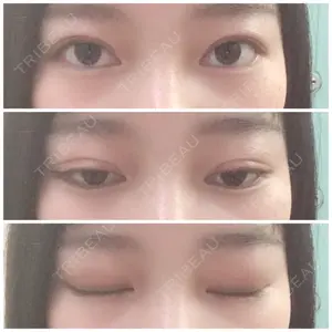 114 days after image