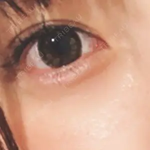 31 days after image