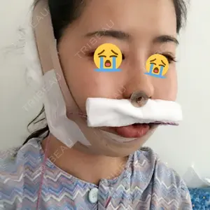 0 days after image